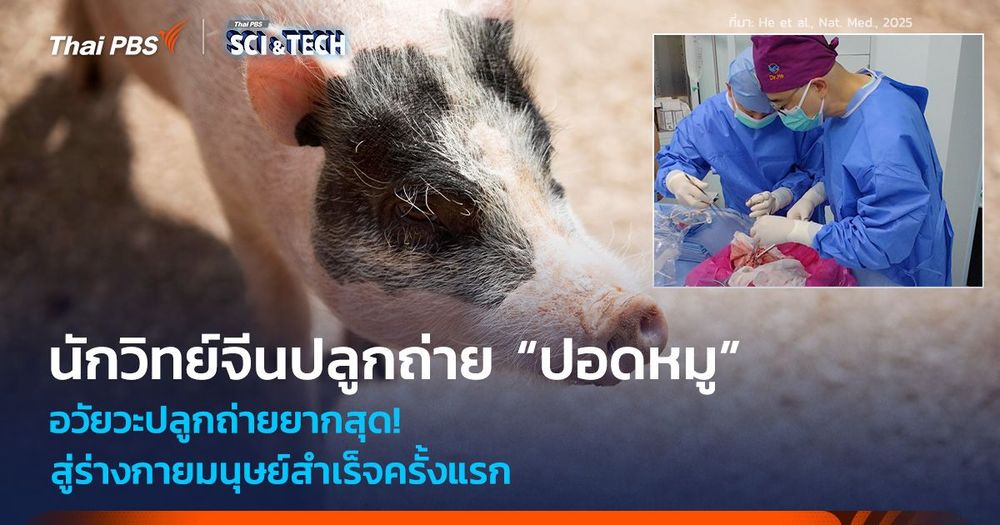 อวัยวะปลูกถ่ายยากสุด! นักวิทย์จีนปลูกถ่าย “ปอดหมู” สู่ร่างกายมนุษย์สำเร็จครั้งแรก