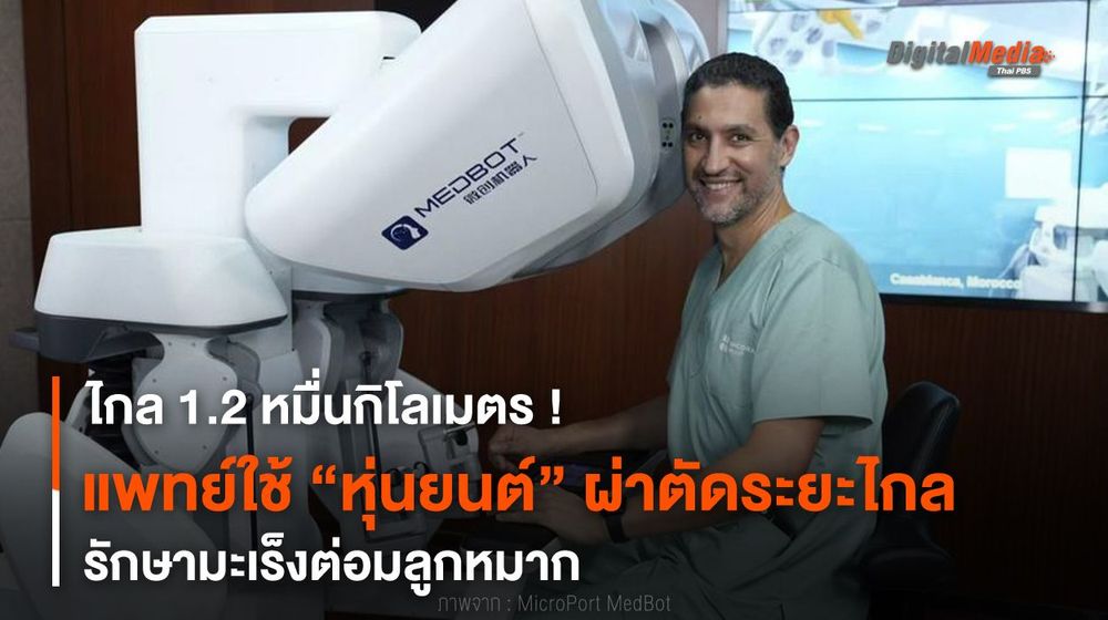 ไกล 1.2 หมื่นกิโลเมตร แพทย์ใช้หุ่นยนต์ผ่าตัดระยะไกลมะเร็งต่อมลูกหมาก