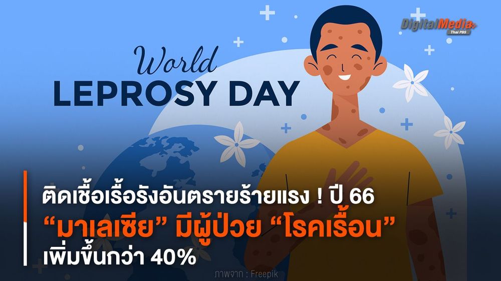 ติดเชื้อเรื้อรังร้ายแรง ! ปี 66 “มาเลเซีย” มีผู้ป่วย “โรคเรื้อน” เพิ่มขึ้น 40%