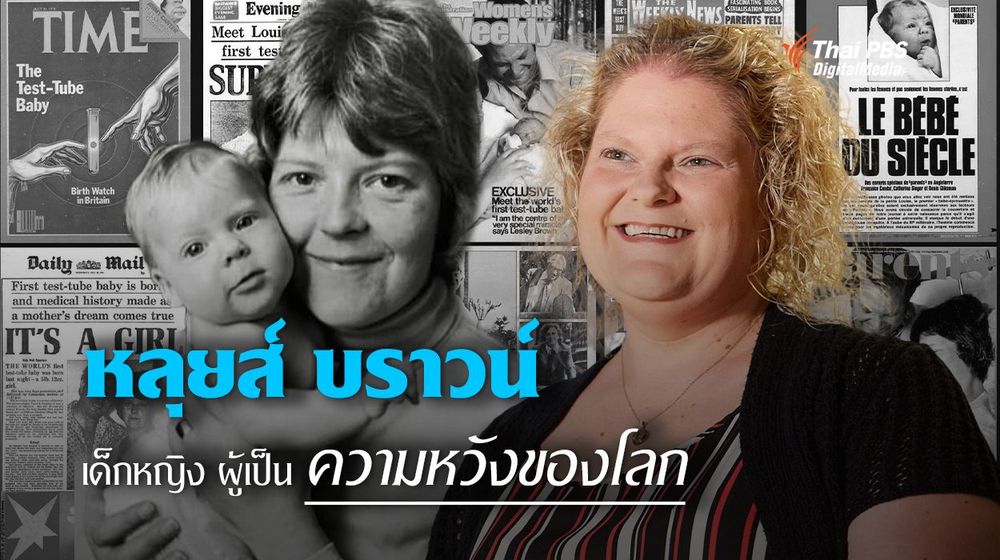 "หลุยส์ บราวน์" เด็กหลอดแก้วคนแรกของโลก ผู้เป็นความหวังของคนมีบุตรยาก