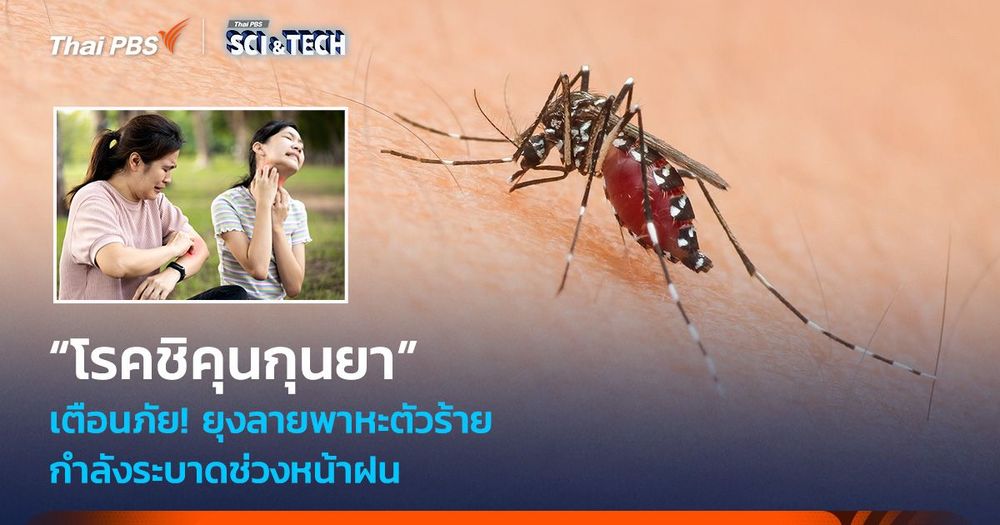 เตือนภัย! ยุงลายพาหะตัวร้าย “โรคชิคุนกุนยา” กำลังระบาดช่วงหน้าฝน 