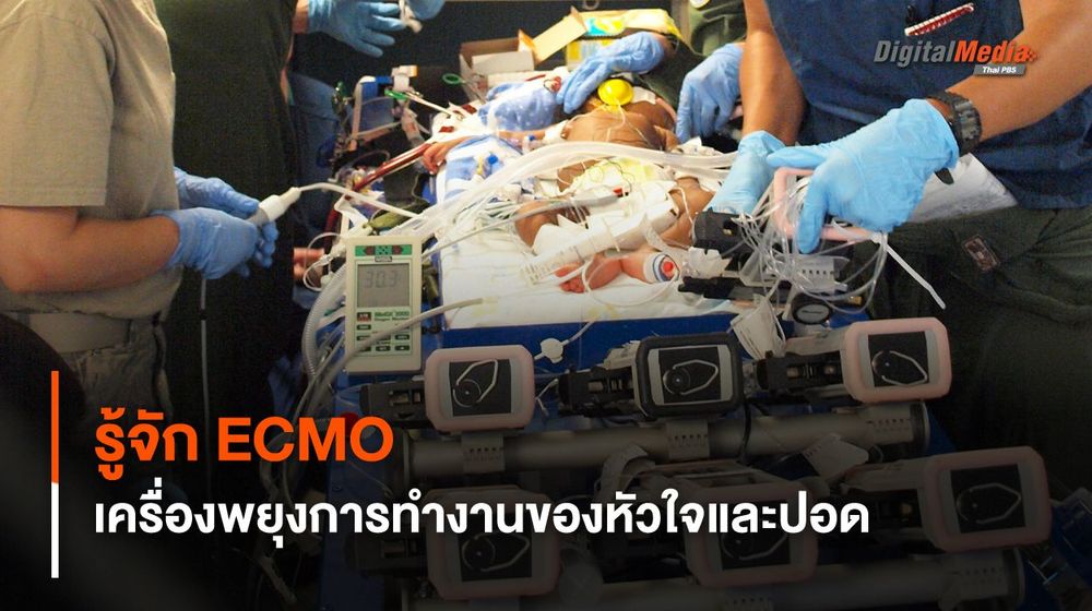 รู้จัก ECMO เครื่องช่วยพยุงการทำงานของหัวใจและปอด