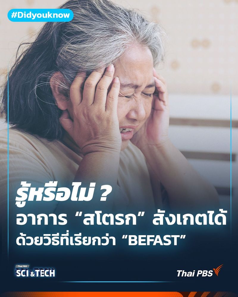 อาการ “สโตรก” สังเกตได้ด้วยวิธีที่เรียกว่า “BEFAST”