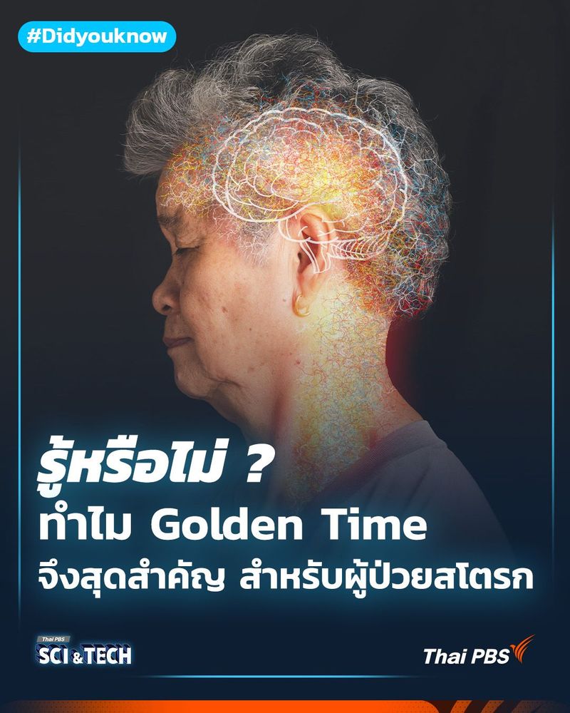 ทำไม Golden Time จึงสุดสำคัญ สำหรับผู้ป่วยสโตรก