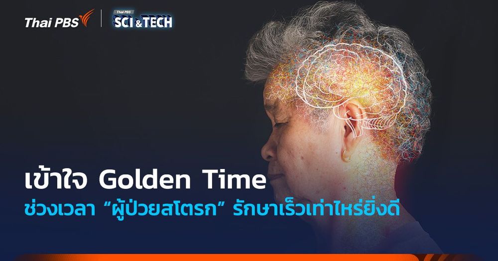 เข้าใจ Golden Time ช่วงเวลา “ผู้ป่วยสโตรก” รักษาเร็วเท่าไหร่ยิ่งดี