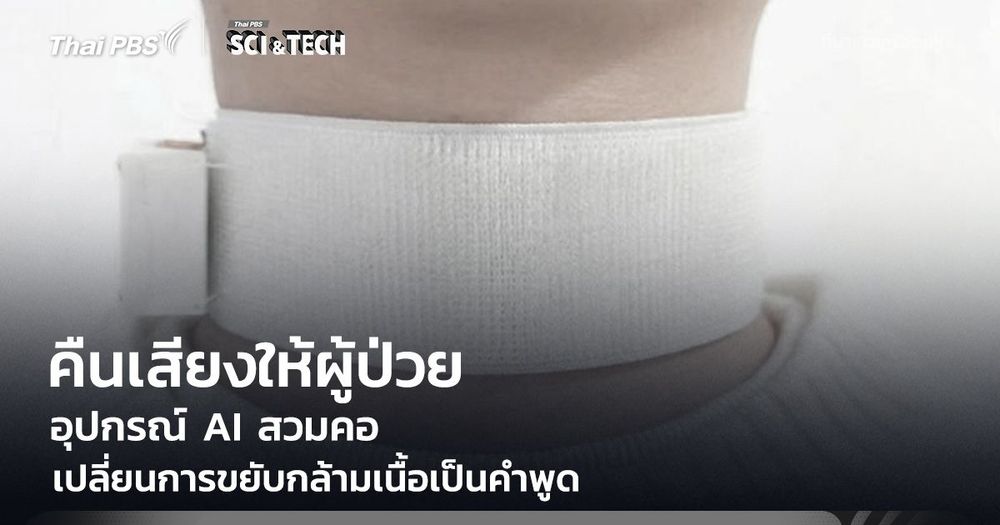 คืนเสียงให้ผู้ป่วย Stroke! อุปกรณ์ AI สวมคอ เปลี่ยนการขยับกล้ามเนื้อเป็นคำพูด สื่อสารได้อีกครั้ง