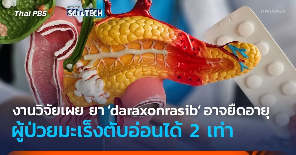 งานวิจัยเผย ยา ‘daraxonrasib’ อาจยืดอายุผู้ป่วยมะเร็งตับอ่อนได้ 2 เท่า