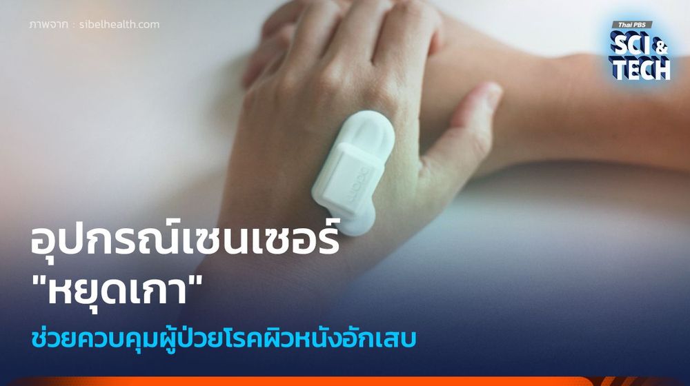 อุปกรณ์เซนเซอร์ "หยุดเกา" ควบคุมการเกาของผู้ป่วยโรคผิวหนังอักเสบ