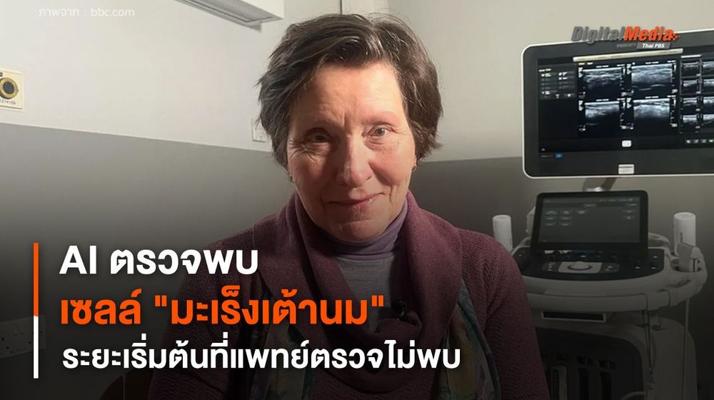AI ตรวจพบเซลล์ "มะเร็งเต้านม" ระยะเริ่มต้นที่แพทย์ตรวจไม่พบ