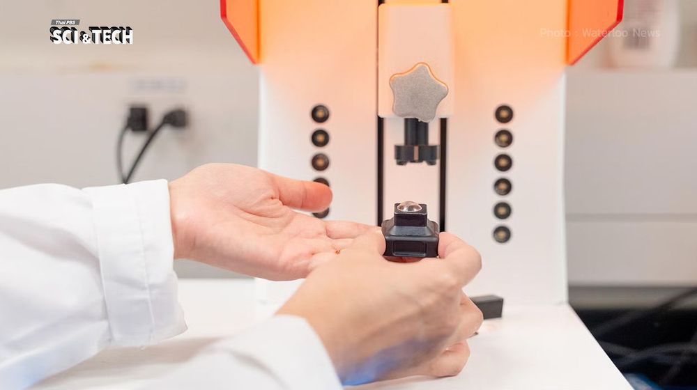 คอนแท็กต์เลนส์ 3D Print พิมพ์เลนส์พอดีตาใน 20 นาที ทางเลือกคนที่มีปัญหากระจกตา