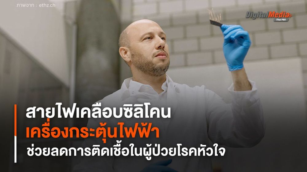 สายไฟเคลือบซิลิโคนสำหรับเครื่องกระตุ้นไฟฟ้า ช่วยลดการติดเชื้อในผู้ป่วยโรคหัวใจ
