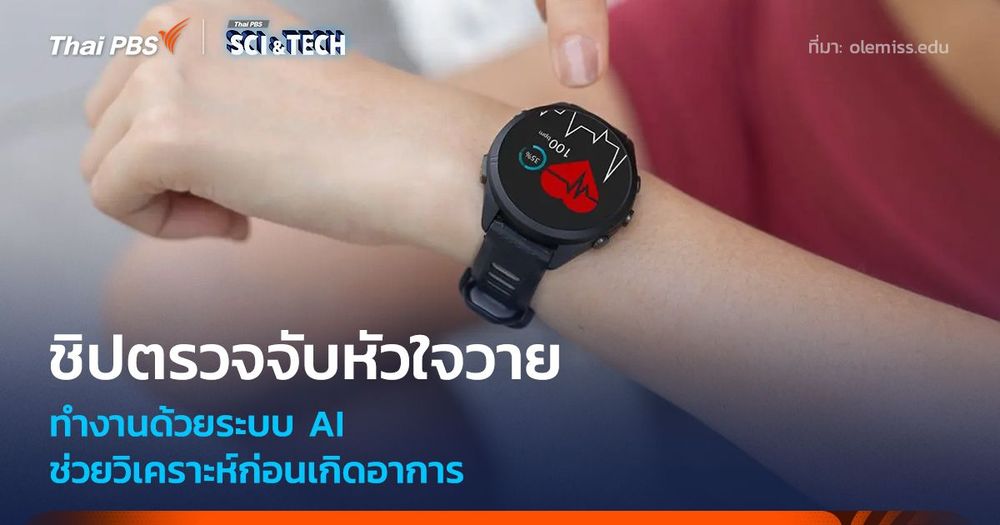 ชิปตรวจจับหัวใจวาย พลัง AI ช่วยวิเคราะห์ก่อนเกิดอาการ