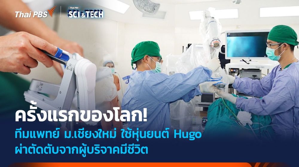 ครั้งแรกของโลก! ทีมแพทย์ ม.เชียงใหม่ ใช้หุ่นยนต์ Hugo ผ่าตัดตับจากผู้บริจาคมีชีวิต