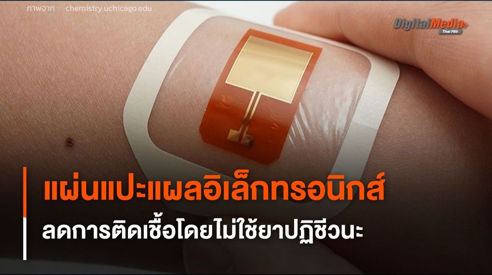 แผ่นแปะแผลอิเล็กทรอนิกส์ ลดการติดเชื้อรุนแรงโดยไม่ใช้ยาปฏิชีวนะ