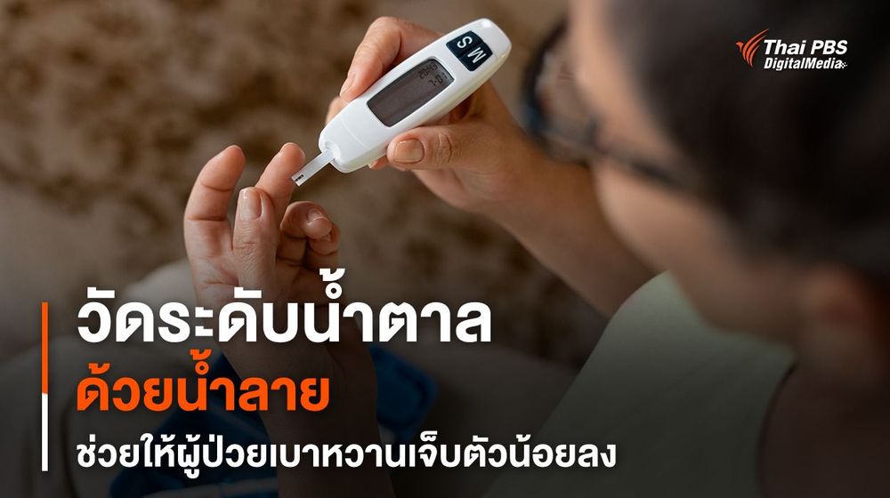 วัดระดับน้ำตาลด้วยน้ำลาย แทนเจาะปลายนิ้วมือ ช่วยผู้ป่วยเบาหวานเจ็บน้อยลง