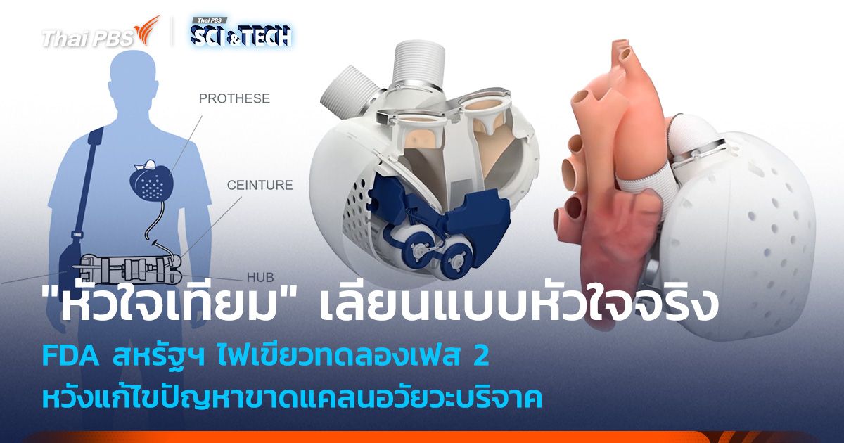 "หัวใจเทียม" เลียนแบบหัวใจจริง แก้ไขปัญหาขาดแคลนอวัยวะบริจาค