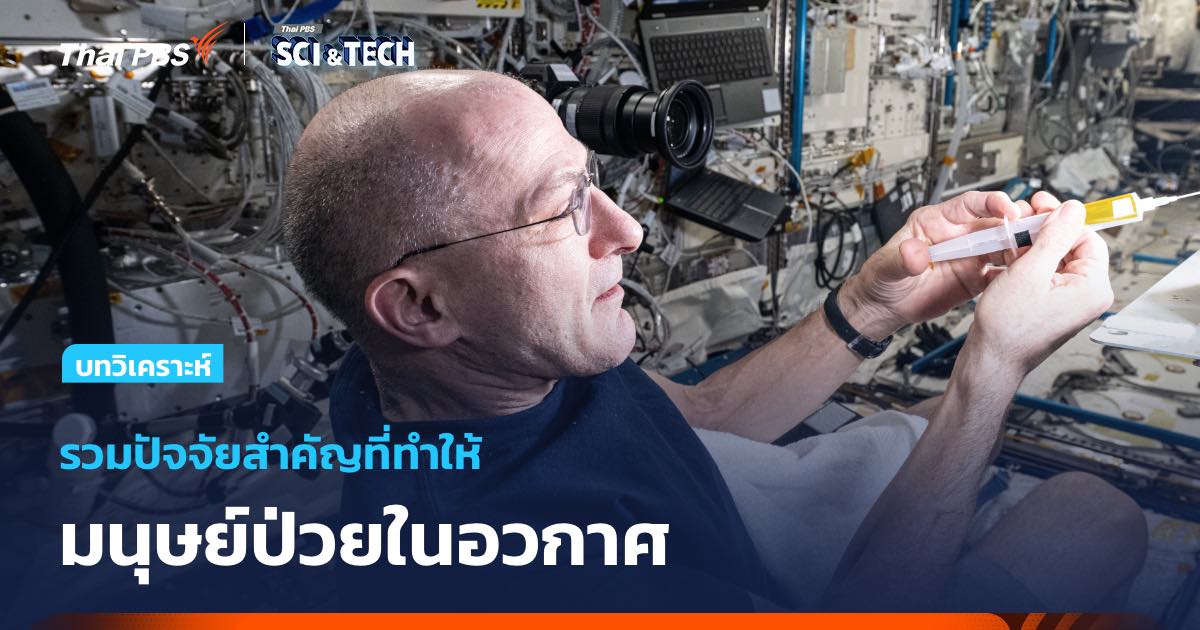 6 สิ่งที่จะทำให้มนุษย์ป่วยในอวกาศ